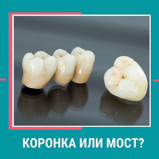 Коронка под 3 4