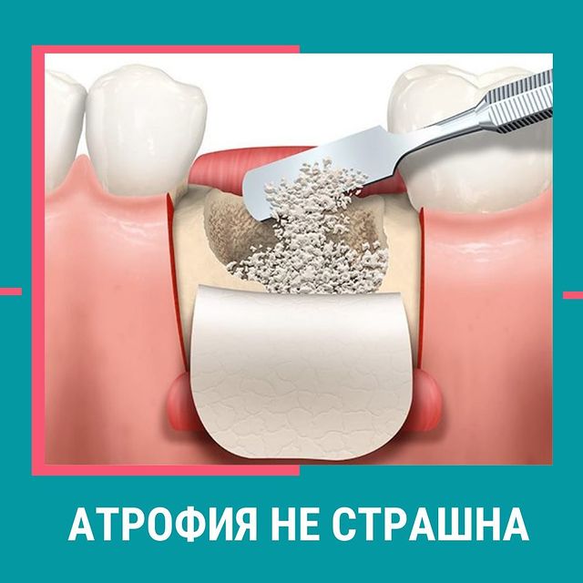 СРС Лучевая диагностика заболеваний зубов, пародонта (кариес, пульпит